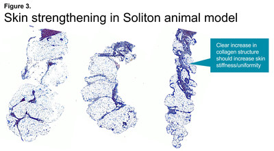 Soliton’s RAP technology combines selective disruption of fibrotic structures with production of new collagen in single non-invasive procedure. (PRNewsfoto/Soliton, Inc.)