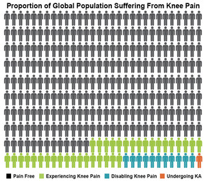 Demand for Knee Replacement Grows 5 Percent Worldwide