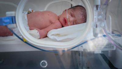 Sohaya a baby girl who is born in the last day of 2018 lying in the nursery in 22 May Hospital in Dolaa Hamdan, Sana'a Governorate. © UNICEF/UN0318240/Aljaberi (CNW Group/UNICEF Canada)