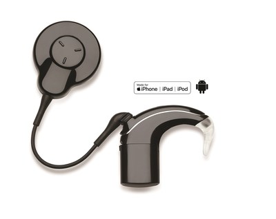 FDA approves new cochlear implant with easier access to MRI and