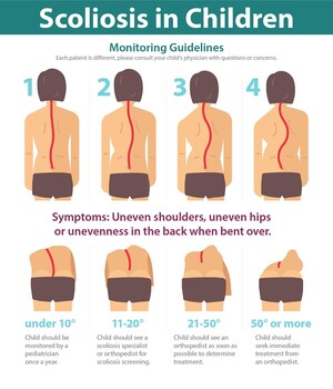 National Scoliosis Center Says Early Detection Of Scoliosis Is Critical To Treatment