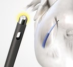 Study Links Use of the Baylis Medical RF Transseptal Needle to Procedural Cost-Savings
