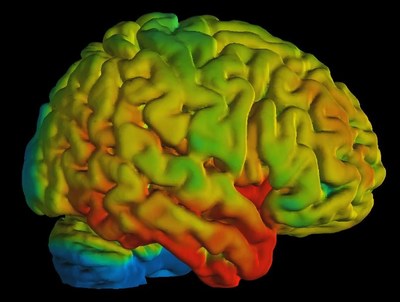 PET/MR image processed by PMOD: Serotonin receptor density in human brain for study of psychiatric disorders. Courtesy A. Hahn, M. Savli, R. Lanzenberger, Medical University of Vienna, Austria.