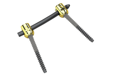 VADER&reg;one pedicle system offers clear visualization of the surgical site post-operatively.