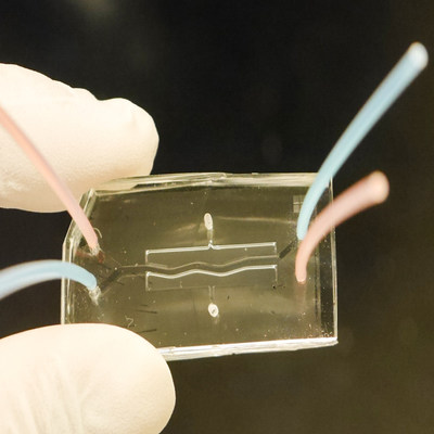 A researcher holds a dual-chamber chip that scientists used to bioengineer human pancreatic tissues to study the cause of Cystic Fibrosis-Related Diabetes, a frequent and deadly complication for people who battle the genetic lung disease cystic fibrosis. The scientists report data from their study in Nature Communications.