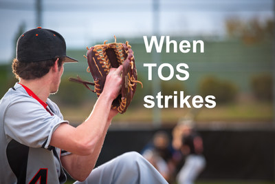 Thoracic Outlet Syndrome doesn't only affect baseball pitchers. The compression syndrome can affect those who do lots of repetitive overhead movements, and is often treated with vascular surgery.