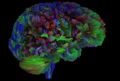 Using latest technologies, including neuroimaging, the institute seek to establish the biology of empathy, then translate that data into compassion-focused medical training for new physicians and programs to improve the well-being of current clinicians and their patients. Photo credit: UC San Diego