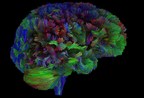 With Landmark Gift, UC San Diego Will Map Compassion in the Brain, then Prove its Power