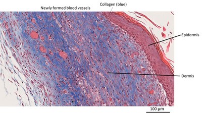 High-magnification detail of a section (stained with Masson's trichrome) collected from a healed wound biopsy treated with BioLexa compound. Note the complete reepithelialization process and the re-forming of an epidermal and dermal layer, with multiple newly formed blood vessels (capillaries). Fibroblasts in the dermis actively deposit collagen (blue).