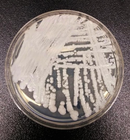 Petri dish culture of C. auris