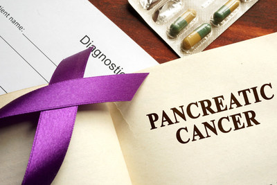 OTraces' Pancreatic Cancer Study Yields Encouraging Results; Further Funding and Testing Needed OTraces' Pancreatic Cancer Study Yields Encouraging Results; Further Funding and Testing Needed