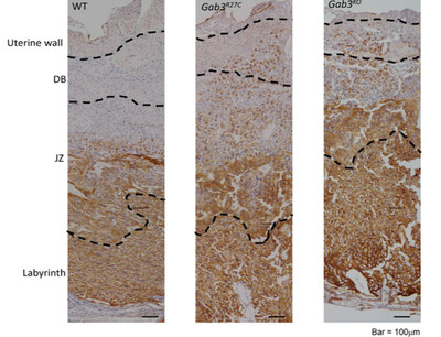 These images of mouse placentas and uterine tissue show the importance of the protein Gab3 for ensuring a healthy delivery. On the left, in normal mice (WT) very few placental trophoblast cells (shown in brown) enter the maternal decidua (DB). This allows proper placenta detachment during delivery. The next two images show much deeper invasion when mice have a mutant form of Gab3 or lack the protein entirely. These conditions can lead to severe bleeding and death during childbirth. These images of mouse placentas and uterine tissue show the importance of the protein Gab3 for ensuring a healthy delivery. On the left, in normal mice (WT) very few placental trophoblast cells (shown in brown) enter the maternal decidua (DB). This allows proper placenta detachment during delivery. The next two images show much deeper invasion when mice have a mutant form of Gab3 or lack the protein entirely. These conditions can lead to severe bleeding and death during childbirth.