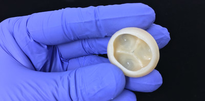 Trileaflet heart valve printed using collagen and Freeform Reversible Embedding of Suspended Hydrogels (FRESH) technology. Trileaflet heart valve printed using collagen and Freeform Reversible Embedding of Suspended Hydrogels (FRESH) technology.