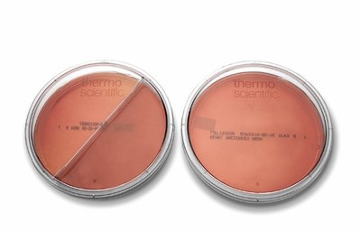 New Thermo Fisher Scientific SmartPlate design delivers enhanced and validated microbiological sample analysis with an extensive and unmatched range of formulations New Thermo Fisher Scientific SmartPlate design delivers enhanced and validated microbiological sample analysis with an extensive and unmatched range of formulations