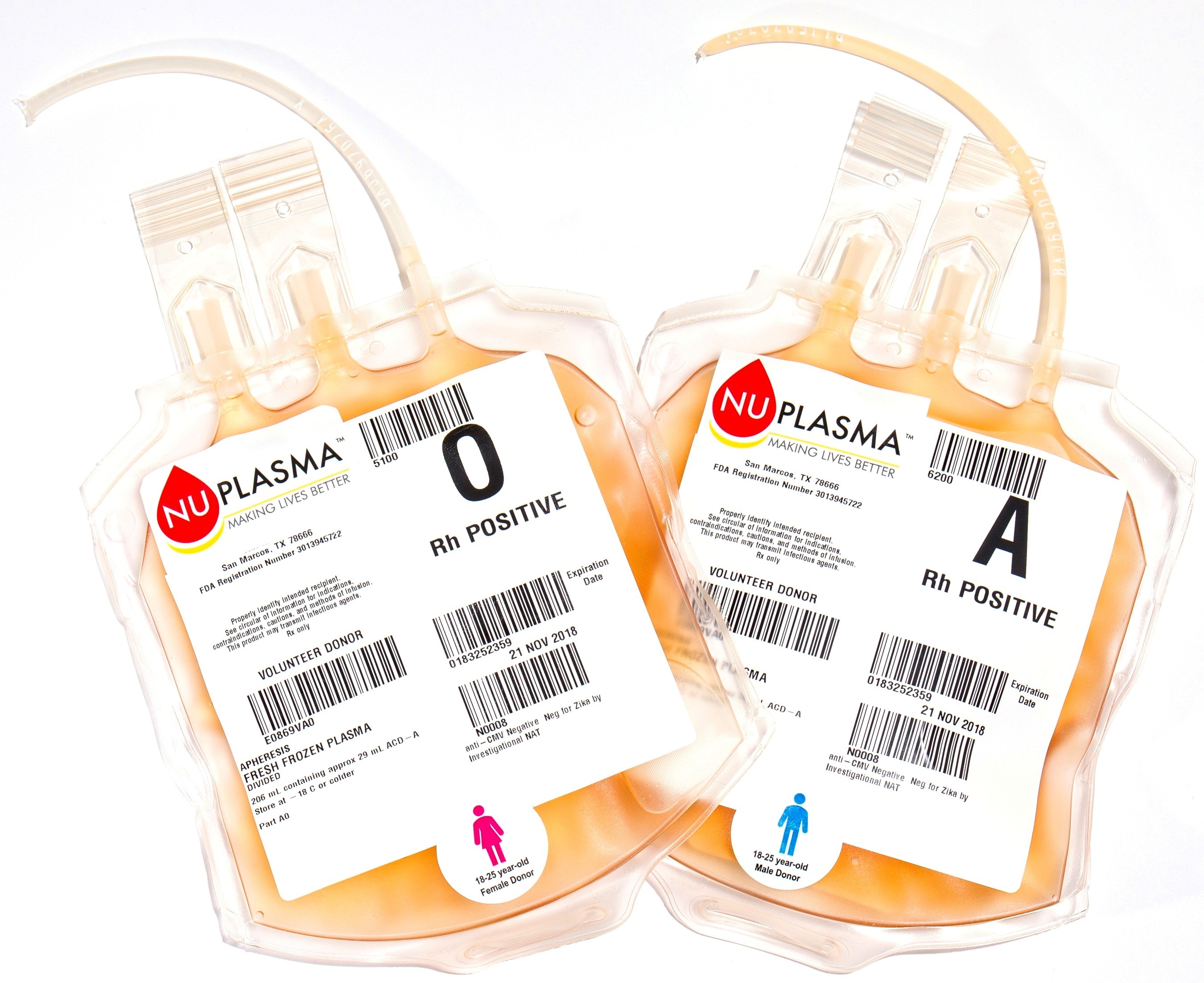 Young Blood Plasma Parkinson S Disease Investigation Six Month Results Show Dramatic Improvements In Motor Symptoms And Mentation Behavior And Mood