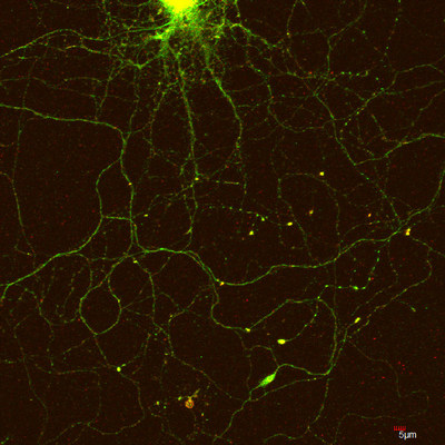 CPEB3 (green) localizing to a neuron's dendrites after stimulation (Credit: Lenzie Ford and Luana Fioriti/Kandel lab/Columbia's Zuckerman Institute).