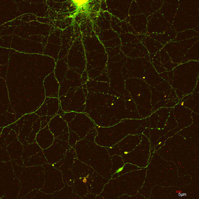 CPEB3 (green) localizing to a neuron's dendrites after stimulation (Credit: Lenzie Ford and Luana Fioriti/Kandel lab/Columbia's Zuckerman Institute). CPEB3 (green) localizing to a neuron's dendrites after stimulation (Credit: Lenzie Ford and Luana Fioriti/Kandel lab/Columbia's Zuckerman Institute).
