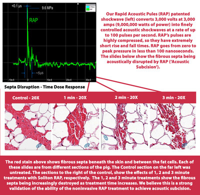 Soliton, Inc. announced results of preclinical studies which reveal its RAP device appears to deliver increased disruption of the fibrotic septa that contribute to the appearance of cellulite with increased treatment time, implying a dose response to the therapy. (PRNewsfoto/Soliton, Inc.) Soliton, Inc. announced results of preclinical studies which reveal its RAP device appears to deliver increased disruption of the fibrotic septa that contribute to the appearance of cellulite with increased treatment time, implying a dose response to the therapy. (PRNewsfoto/Soliton, Inc.)