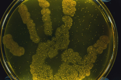 The coating is effective against five different bacteria that are responsible for hospital-acquired infections &ndash; Staphylococcus aureus, Staphylococcus epidermidis, Enterococcus, Pseudomonas aeruginosa and Escherichia coli