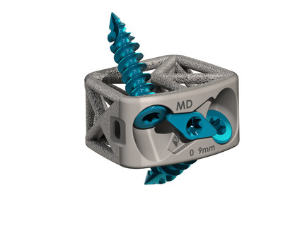 Cervical Spine Truss System – Stand-Alone Cervical Spine Truss System – Stand-Alone