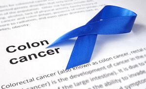 OPCs in French Grape Seed VX1 Block Multiple Tumor Pathways to Defeat Colorectal Cancer