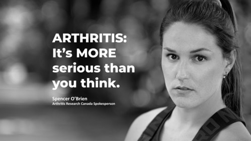 Arthritis impacts over 6 million Canadians of all ages and is a life-altering disease. (CNW Group/Arthritis Research Canada)