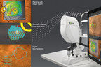 Navilas® at Euretina 2019: Navigated Retinal Laser Therapy - a Unique and Effective Treatment Platform