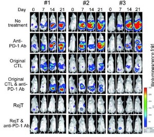 Juntendo University Research: IPS Based Approach for Treating Virus-induced Tumors