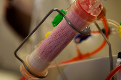 Patients suffering from infections could one day be treated with a dialysis-like machine to have their blood cleansed quickly and easily, making this technology highly beneficial in hospitals and lower-income areas alike. Credit: Wyss Institute at Harvard University