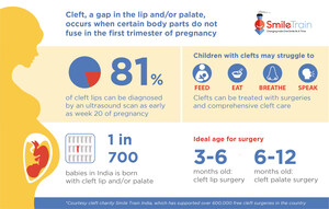 Smile Train India Partners With FOGSI to Drive Early Diagnosis and Intervention for Children With Clefts