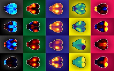 Brain activity of mice during decision-making tasks. Credit: Anne Churchland Brain activity of mice during decision-making tasks. Credit: Anne Churchland