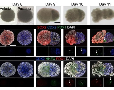 This image from a study published today in Nature shows the first days of development of the world's first connected set of human organoids--a liver, pancreas and biliary tract. The project was led by Takanori Takebe, MD, Cincinnati Children's. This discovery provides an organoid system that can be used as an advanced tool for studying how organs develop and how new drugs may affect functioning human tissue. This image from a study published today in Nature shows the first days of development of the world's first connected set of human organoids--a liver, pancreas and biliary tract. The project was led by Takanori Takebe, MD, Cincinnati Children's. This discovery provides an organoid system that can be used as an advanced tool for studying how organs develop and how new drugs may affect functioning human tissue.